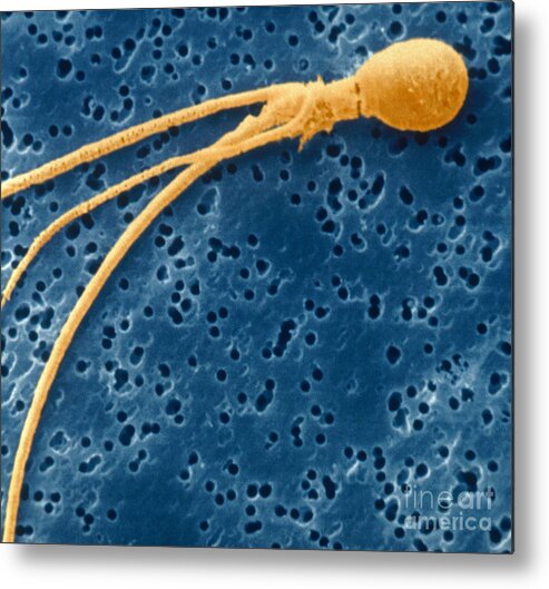 Abnormal Metal Print featuring the photograph Abnormal Sperm by Scimat