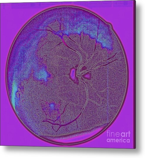 Eye Metal Print featuring the photograph Digital Art - Retinal Imaging by Mars Besso