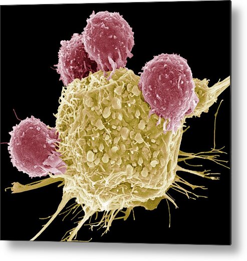 Disease Metal Print featuring the photograph T Lymphocytes And Cancer Cell, Sem by Steve Gschmeissner