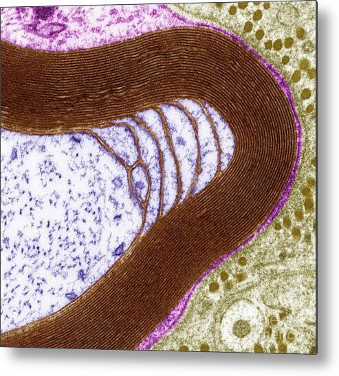 Axon Metal Print featuring the photograph Myelinated Nerve #4 by Steve Gschmeissner/science Photo Library