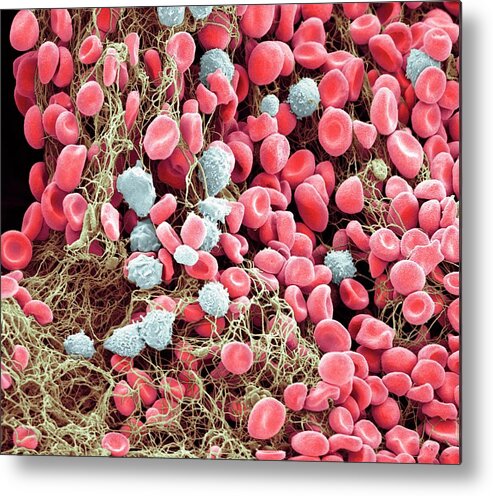 Anatomical Metal Print featuring the photograph Bone Marrow #1 by Steve Gschmeissner