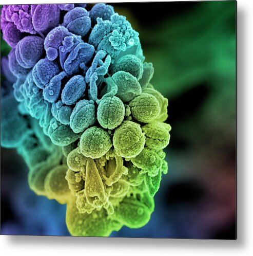 Streptococcus Metal Print featuring the photograph Streptococcus Bacteria #1 by Science Photo Library