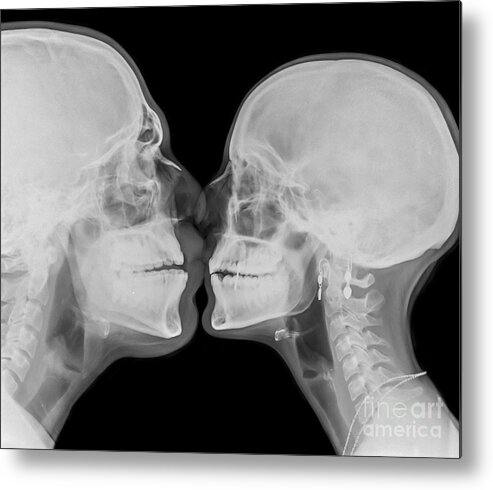 Bizarre Metal Print featuring the photograph X-ray kissing #1 by Guy Viner