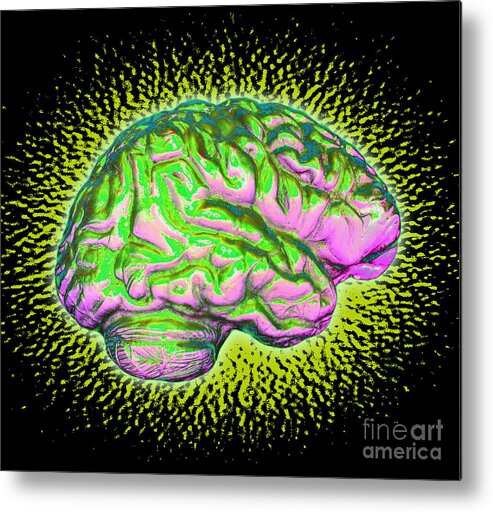 Brain Metal Print featuring the photograph Brain #10 by Dennis D Potokar