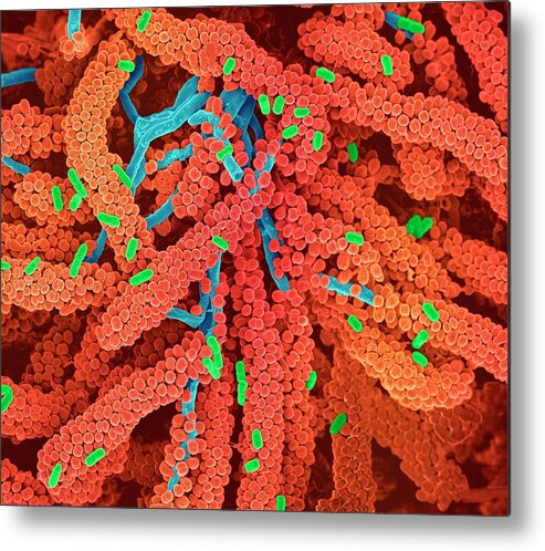 Streptococcus Metal Print featuring the photograph Streptococcus Bacteria #11 by Science Photo Library