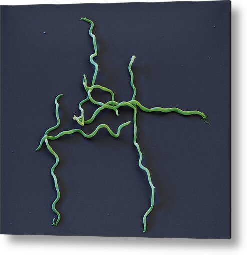Lyme Disease Metal Print featuring the photograph Borrelia Bavariensis, Sem #2 by Eye of Science