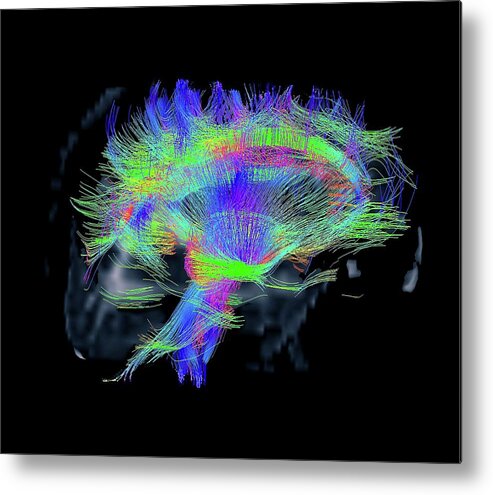 Human Metal Print featuring the photograph White Matter Fibres #2 by Zephyr