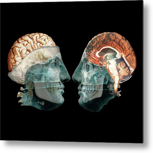 Black Background Metal Print featuring the photograph Thought by Zephyr/science Photo Library