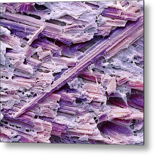 Uric Acid Metal Print featuring the photograph Uric Acid Crystals by Steve Gschmeissner