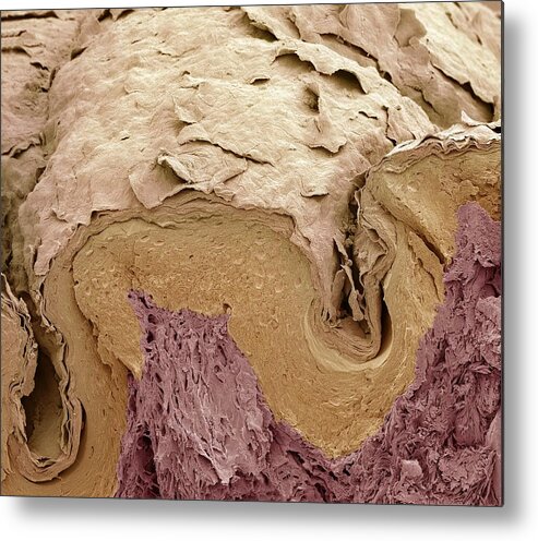 Scanning Electron Micrograph Metal Print featuring the photograph Finger skin, SEM by Science Photo Library