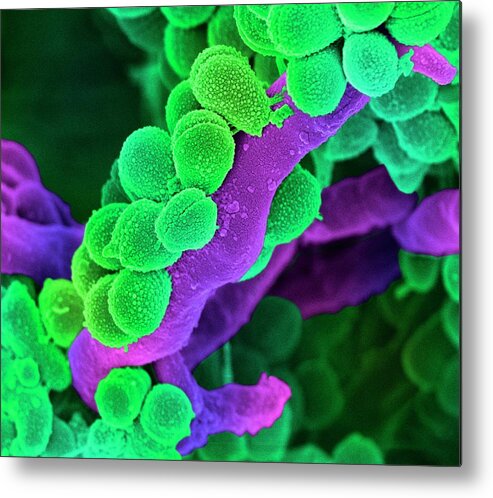 Streptococcus Metal Print featuring the photograph Oral Streptococcus Bacteria by Science Photo Library