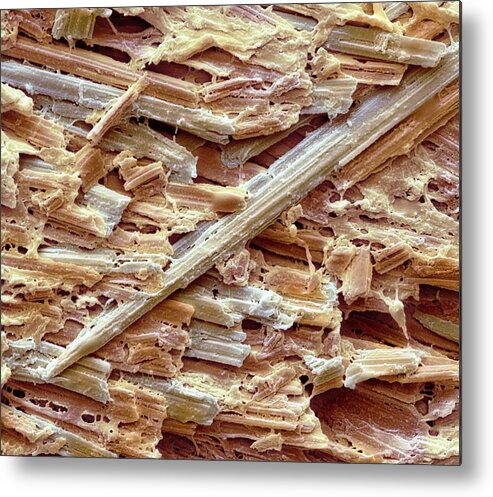 Uric Acid Metal Print featuring the photograph Uric Acid Crystals by Steve Gschmeissner