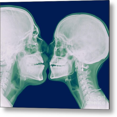 Bizarre Metal Print featuring the photograph X-ray kissing by Guy Viner