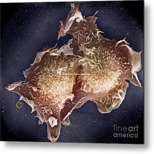 Cell Metal Print featuring the photograph Cell Culture #2 by Science Source