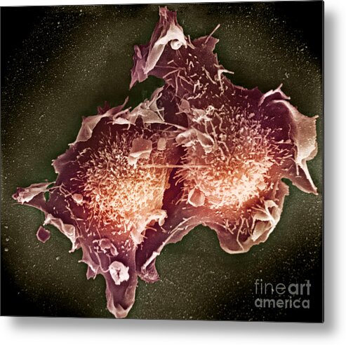 Cell Metal Print featuring the photograph Cell Culture by Science Source