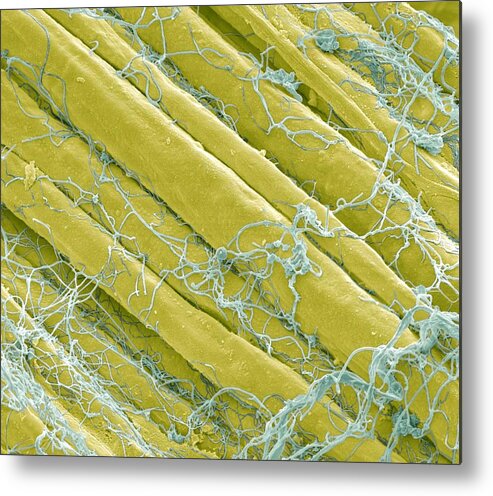 Anatomy Metal Print featuring the photograph Optic Nerve Fibres, Sem #1 by Steve Gschmeissner