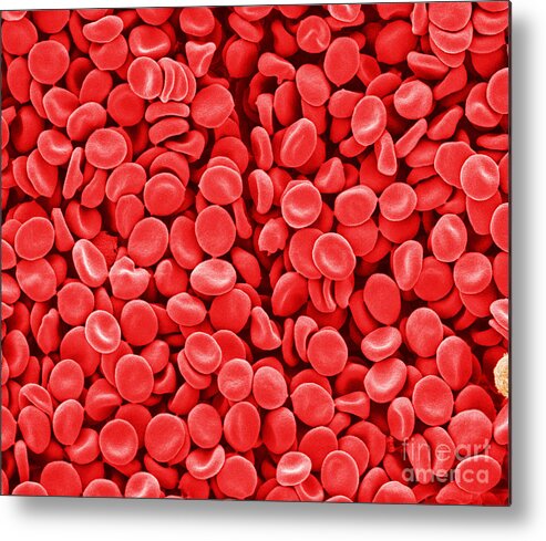 Red Blood Cells Metal Print featuring the photograph Red Blood Cells, Sem by Scimat