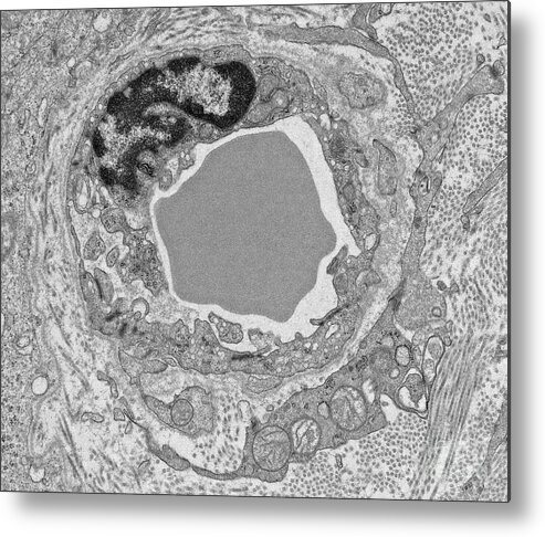 Basement Membrane Metal Print featuring the photograph Capillary #1 by Steve Gschmeissner/science Photo Library