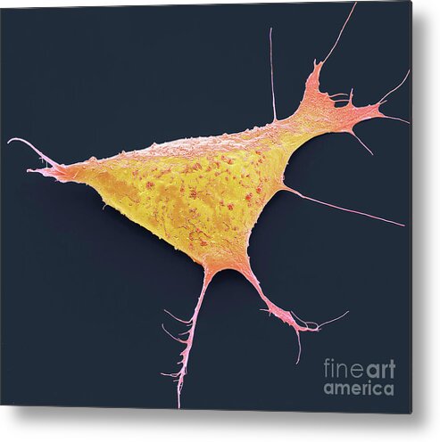 Anatomical Metal Print featuring the photograph Human Induced Pluripotent Cell. #6 by Steve Gschmeissner/science Photo Library