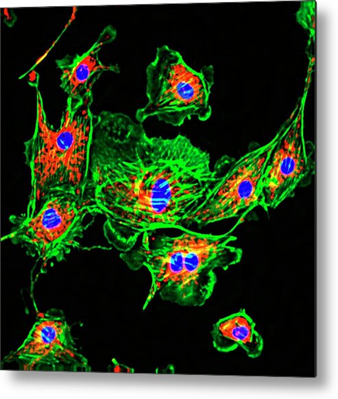 Cell Metal Print featuring the photograph Pulmonary Artery Cells #1 by R. Bick, B. Poindexter, Ut Medical School/science Photo Library