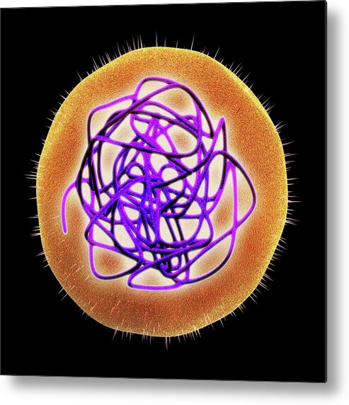 Infection Metal Print featuring the photograph Rubella (german Measles) Virus #1 by Alfred Pasieka