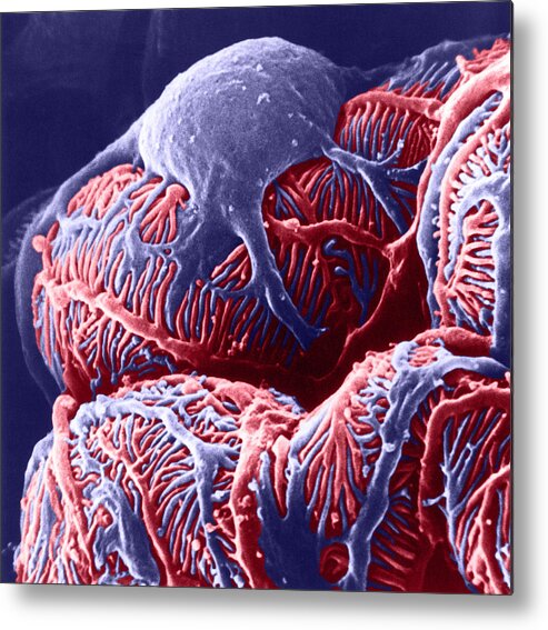 System Metal Print featuring the photograph Kidney Glomerulus, Sem #3 by Don W Fawcett