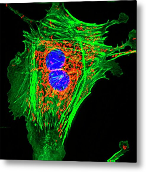 Cell Metal Print featuring the photograph Pulmonary Artery Cells #2 by R. Bick, B. Poindexter, Ut Medical School/science Photo Library