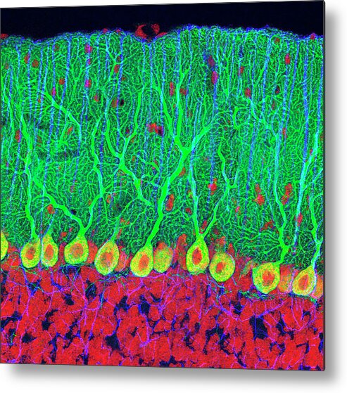 Purkinje Cell Metal Print featuring the photograph Purkinje Nerve Cells In The Cerebellum by Thomas Deerinck, Ncmir