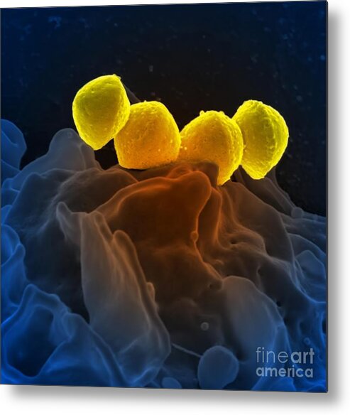 Microbiology Metal Print featuring the photograph Streptococcus Pyogenes Bacteria Sem by Science Source