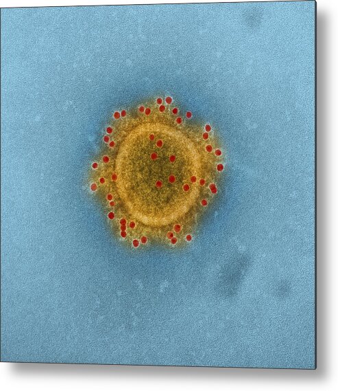 Science Metal Print featuring the photograph Mers Coronavirus Particles, Tem #3 by Science Source