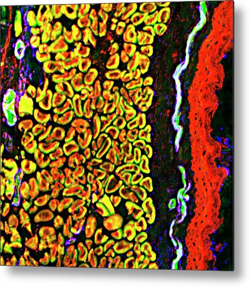 Tissue Metal Print featuring the photograph Throat Tissue by R. Bick, B. Poindexter, Ut Medical School/science Photo Library
