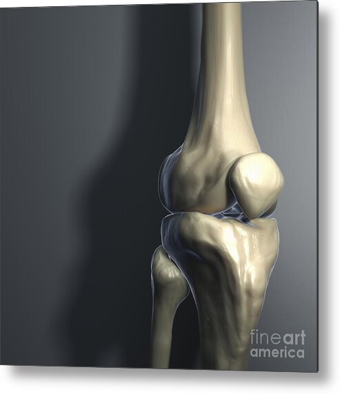 Knee Cap Metal Print featuring the photograph Knee Bones #9 by Science Picture Co