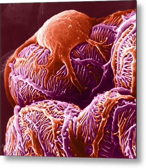 System Metal Print featuring the photograph Kidney Glomerulus, Sem by Don W. Fawcett