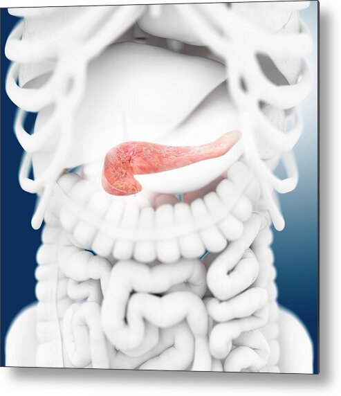 Pancreas Metal Print featuring the photograph Pancreas by Springer Medizin