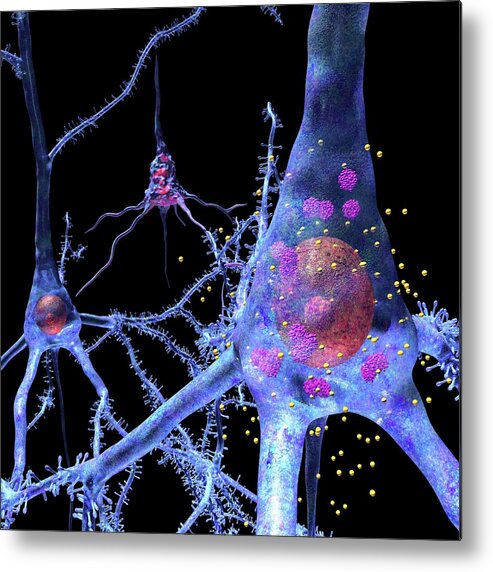 Disease Metal Print featuring the photograph Prion Disease Treatment by Russell Kightley