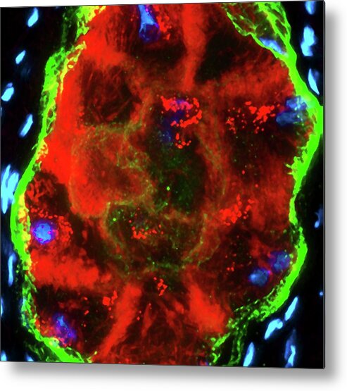 Actin Metal Print featuring the photograph Purkinje Fibres by R. Bick, B. Poindexter, Ut Medical School/science Photo Library