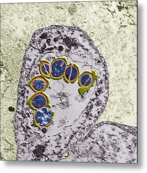 Pulmonary Inflammation Metal Print featuring the photograph Streptococci In Lung Cell, Tem by Eye of Science