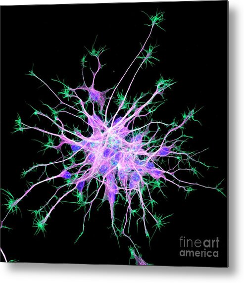 Actin Metal Print featuring the photograph Neurons From Stem Cells #1 by Dr Torsten Wittmann/science Photo Library