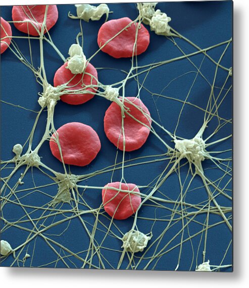 Blood Metal Print featuring the photograph Blood Cells #10 by Meckes/ottawa