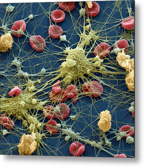 Blood Metal Print featuring the photograph Blood Cells #11 by Meckes/ottawa