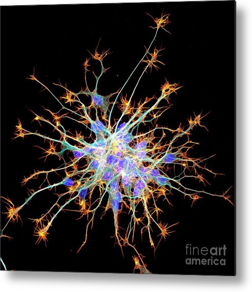 Actin Metal Print featuring the photograph Neurons From Stem Cells by Dr Torsten Wittmann/science Photo Library