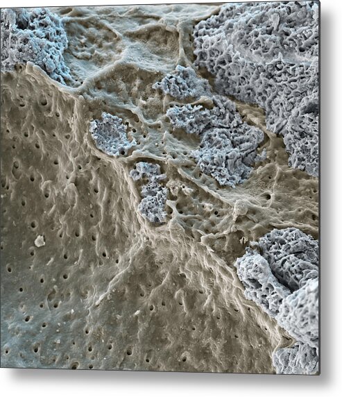 Color Metal Print featuring the photograph Dentin & Tooth Enamel, Sem by Meckes/ottawa