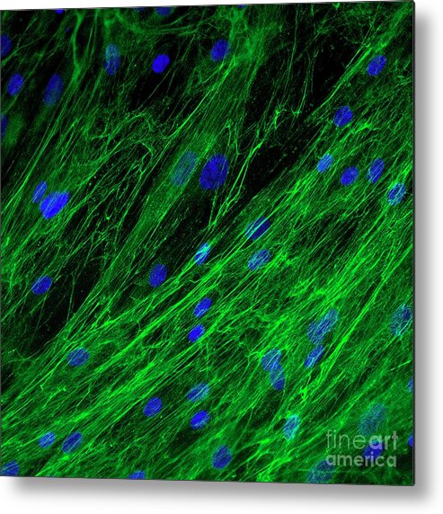 Biological Metal Print featuring the photograph Dermal Fibroblast Cells by Daniel Schroen, Cell Applications Inc/science Photo Library