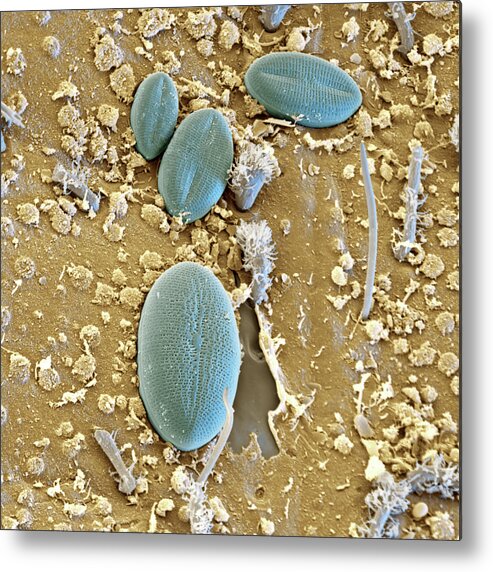 Diatom Metal Print featuring the photograph Diatoms On Mayfly Surface, Sem by Eye Of Science