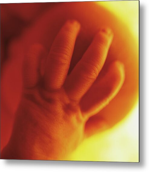 Colour Metal Print featuring the photograph Womb Series #1 by Anne Geddes