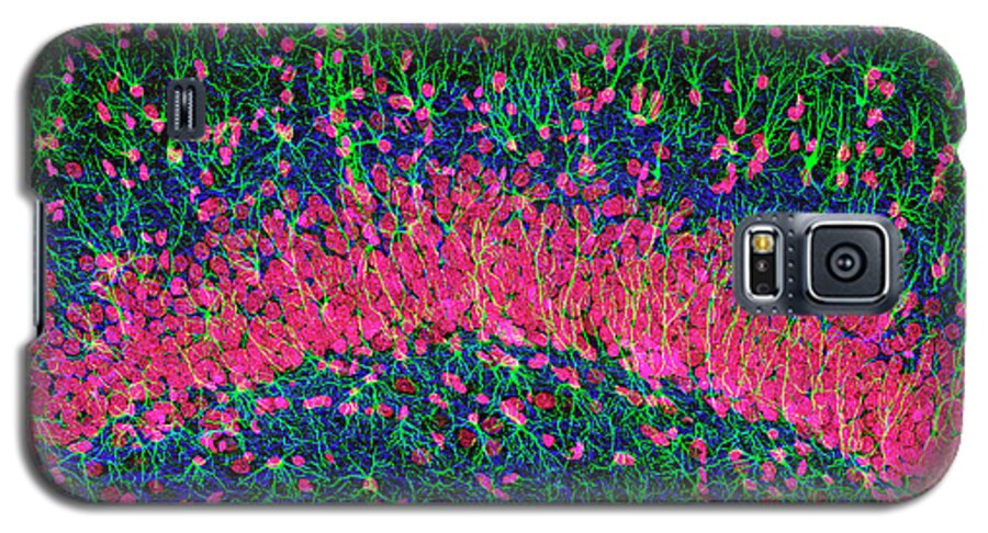 Hippocampus Galaxy S5 Case featuring the photograph Hippocampus Brain Tissue by Thomas Deerinck, Ncmir