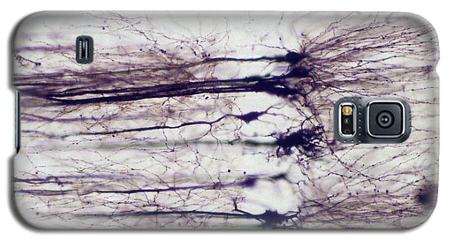 Anatomical Galaxy S5 Case featuring the photograph Nerve Cells by Overseas/collection Cnri/spl