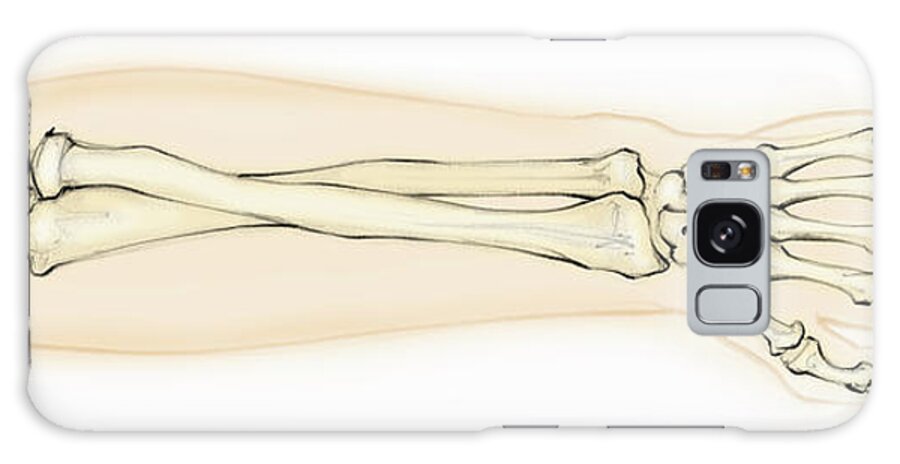 Aerial View Galaxy Case featuring the photograph Biomedical Illustration Of Bones #1 by Ikon Ikon Images