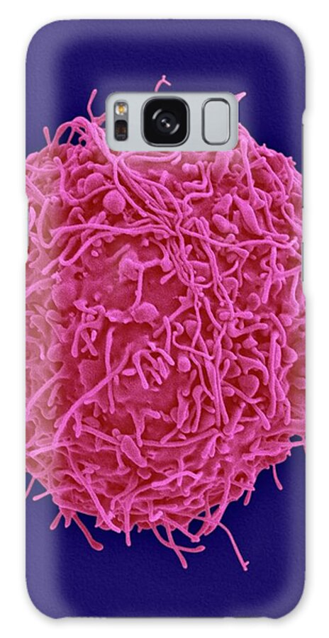 29466d Galaxy Case featuring the photograph Chinese Hamster Ovary Cell #2 by Dennis Kunkel Microscopy/science Photo Library
