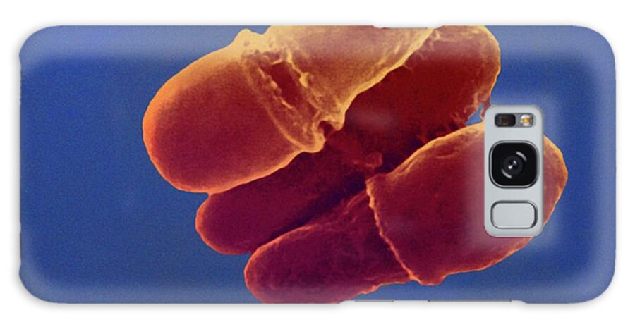 Malassezia Lipophilis Galaxy Case featuring the photograph Malassezia Skin Fungus #2 by Ami Images